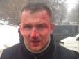 Хіти тижня. Однопартійці жорстко помстилися причетним до побиття нардепа (відео)